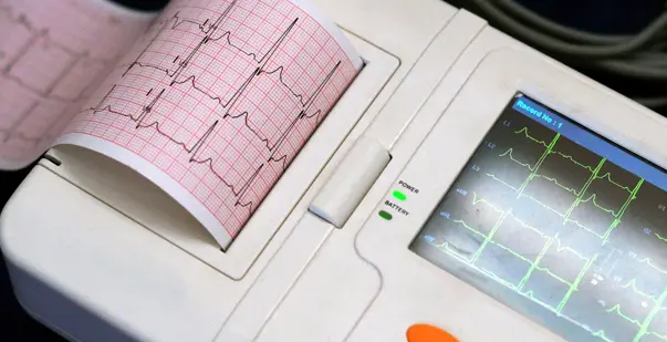 Supraventricular Tachycardia Causes, Symptoms, and Treatment Options