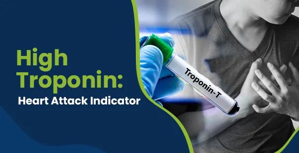 Troponin Levels – The Heart Attack Blood Test post img